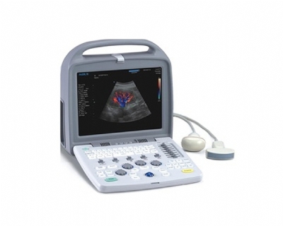 Máy siêu âm Doppler màu Apogee 1100 